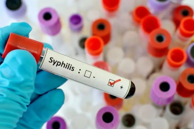 S&iacute;filis en Entre R&iacute;os: La tasa aument&oacute; un 72% en 2025, superando el promedio nacional