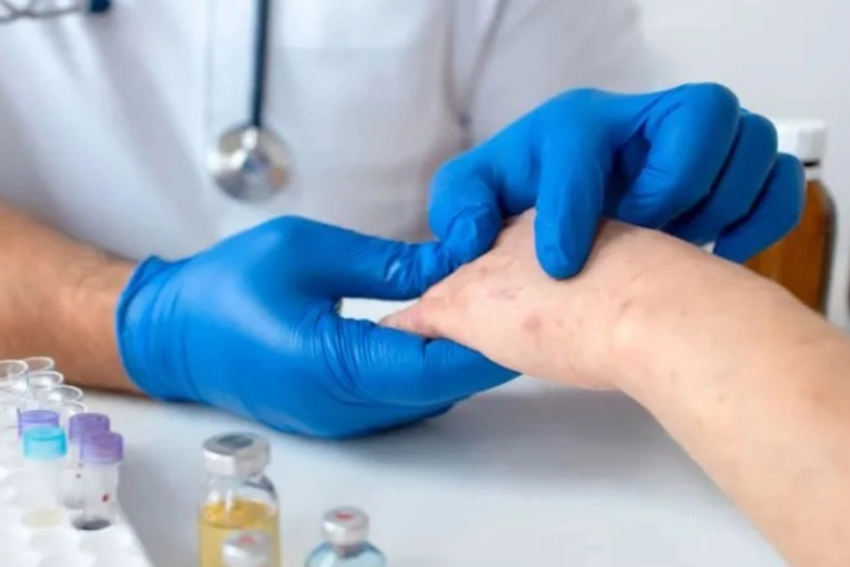 Sífilis en Gualeguaychú: los números que se desprenden de los centros de salud públicos